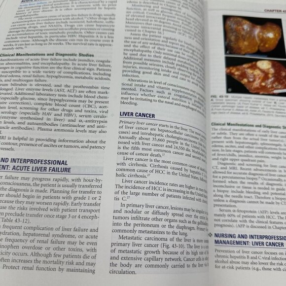 Medical Surgical Nursing Vol 2 10th Edition Textbook Lewis Bucher Harding - Picture 10 of 12